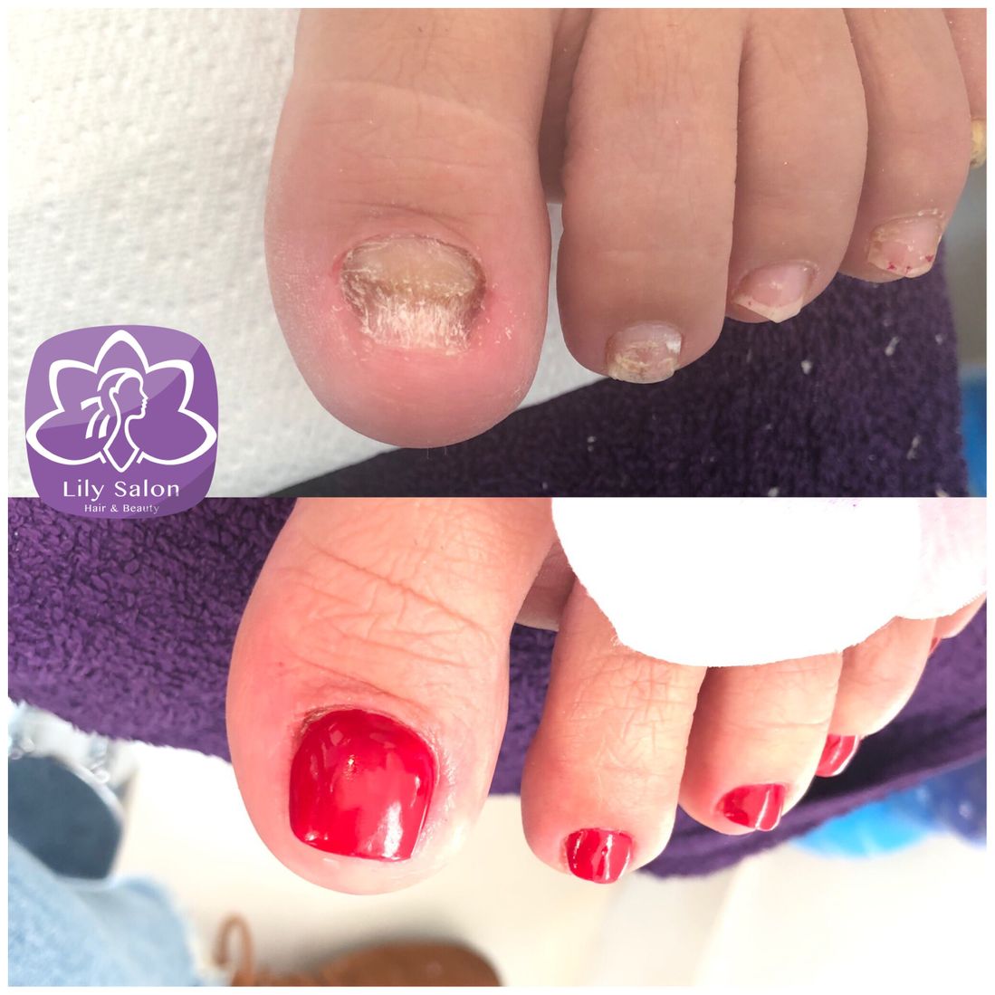 nail repair edgware north london nail near me