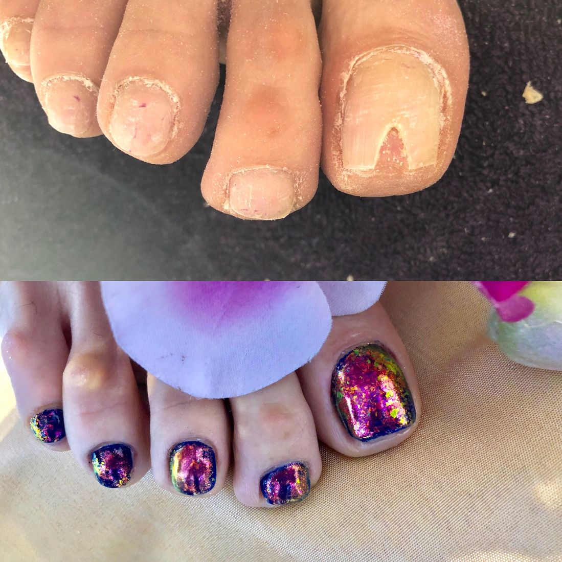 nail repair edgware north london